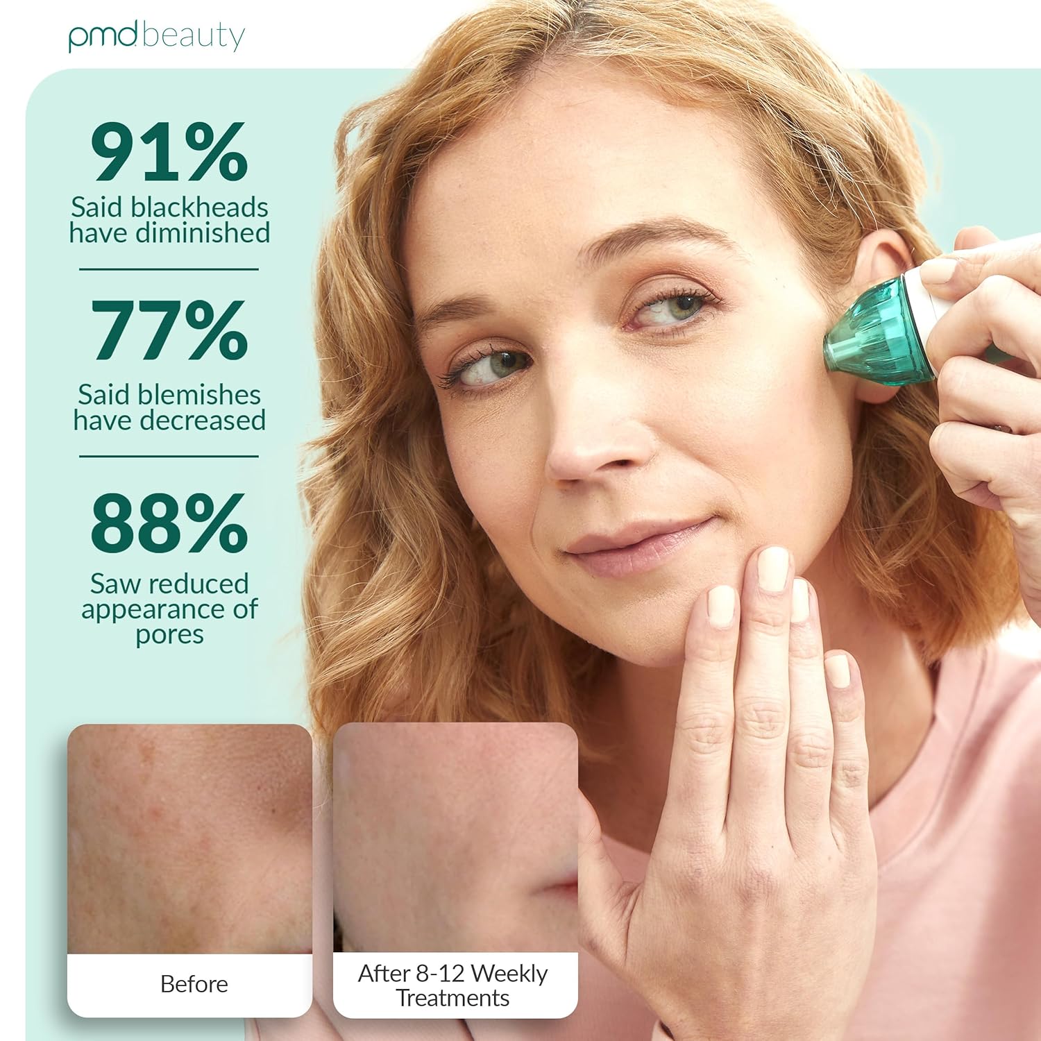 ProSkin Microderm Daily Facial Kit