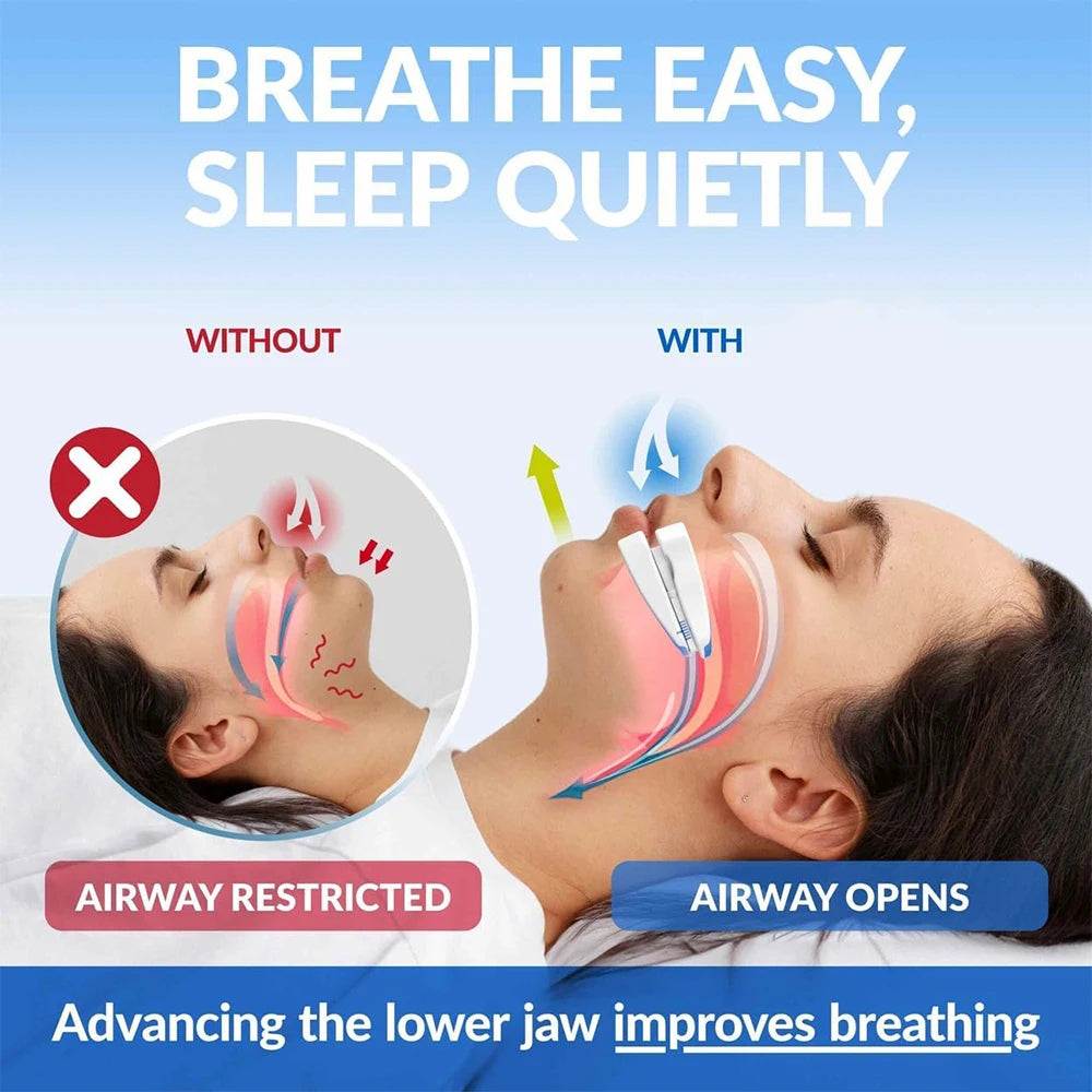 SilentSleep Adjustable Night Mouth Guard